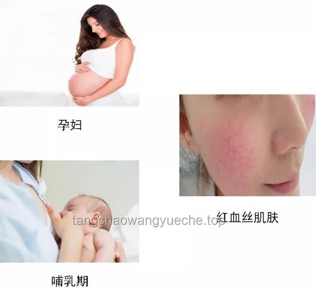 Labubu牙套佩戴与护理指南：轻松掌握，美丽加分